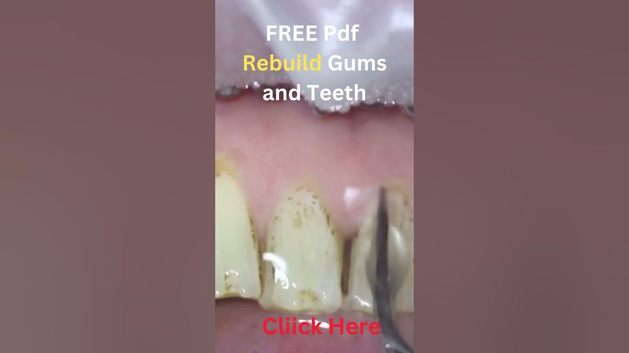 Mineral to rebuild Gums and Teeth 16 - YouTube - 8 Second Mineral Ritual For Teeth