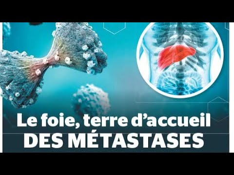 Vidéo: Trouvé Un Moyen De Lutter Contre La Forme Mortelle Du Cancer - Vue Alternative