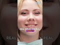 Dentists stop hiding your work and start converting  Dentist Marketing Media #shorts
