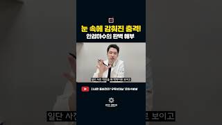 안검하수 완벽해부! #안검하수 #눈성형 #쌍꺼풀수술 #졸린눈 #눈매교정 #눈재수술 #눈성형잘하는곳 #눈재수술잘하는곳 #은하수성형외과