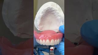 Denture Try-In #lsk121shorts #dentist #teeth
