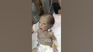 Bayi Reckover Bilirubin Tinggi berdoa untuk bayi Kesadaran untuk orang-orang #bayitidur #babyleo #sikecil