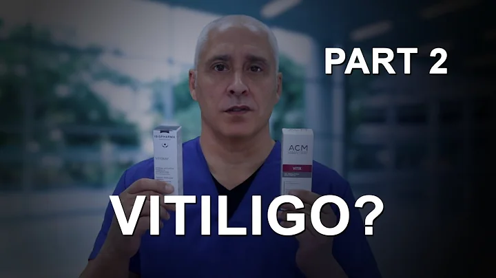 VITILIGO? -  solutions part 2