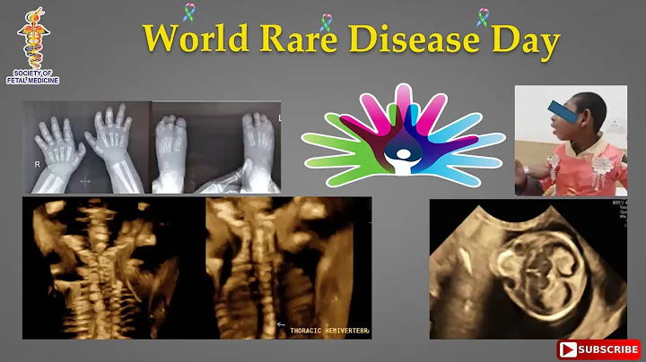 World Rare Disease Day