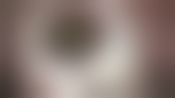 Pacman IOL exchange technique