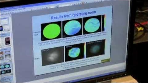 Detecting Oral Cancer