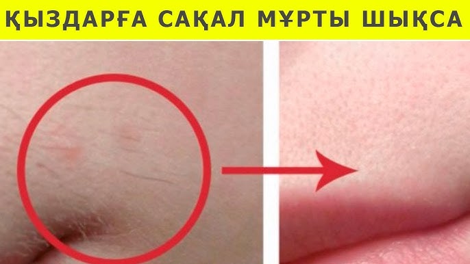 Гинекологқа тыңшылық