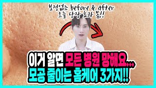 시술없이 모공 줄이는법! 모공축소 홈케어 3가지 &quot;피부과에 돈버리지 마세요! 집에서 직접 모공관리하세요!&quot;