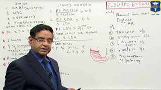 Dr Bhatia discussing on PLEURAL EFFUSION in #LastMinuteRevisionPointDiscussionSeries