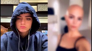 Dixie D'Amelio is BALDING!!? (losing hair)