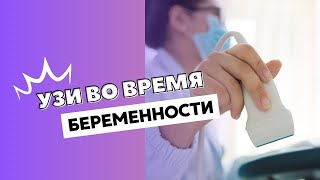УЗИ ПРИ БЕРЕМЕННОСТИ #doctorberezovska  #olenaberezovska #беременность  #УЗИ