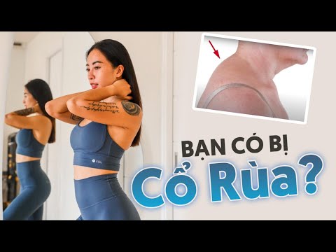 Video: 8 cách để thoát khỏi cổ cứng