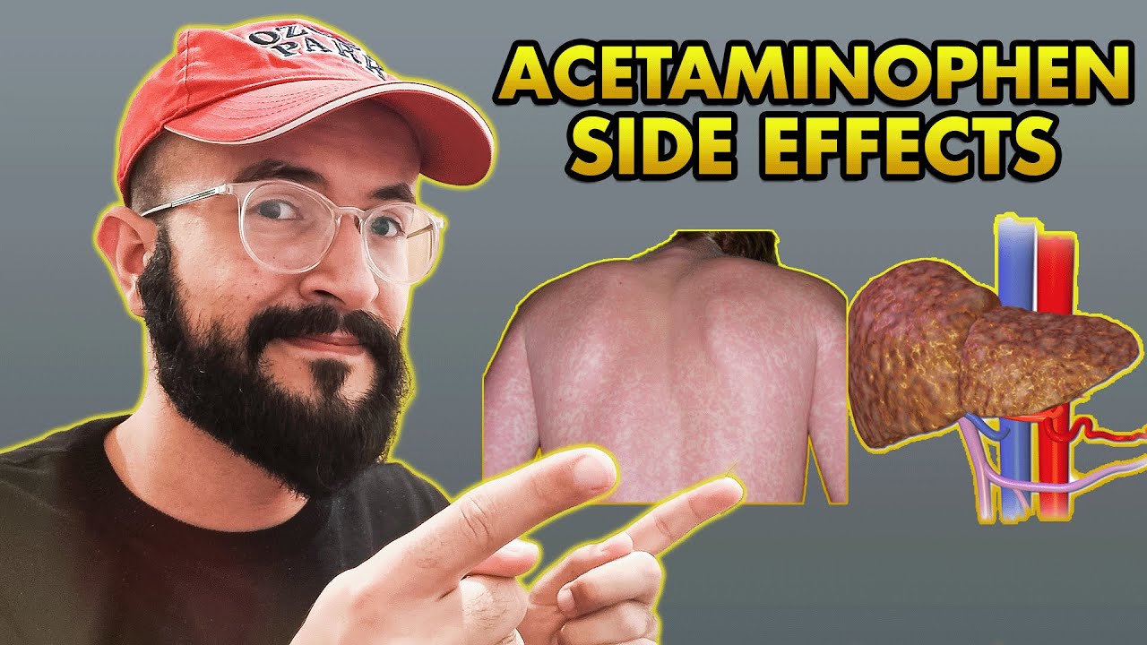 4 IMPORTANT Acetaminophen Side Effects