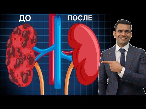 Как Вылечить И Очистить Свои Почки! Доктор Вивек.