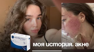 Π²ΠΈΠ΄Π΅ΠΎ: ΠΠΠ― ΠΠ‘Π’ΠΠ ΠΠ― ΠΠΠΠ. ΠΠΠΠΠΠ£Π’ΠΠ. Π¦ΠΠΠ« ΠΊΠ°ΡΡΠΈΠ½ΠΊΠ°: ΠΠΠ― ΠΠ‘Π’ΠΠ ΠΠ― ΠΠΠΠ. ΠΠΠΠΠΠ£Π’ΠΠ. Π¦ΠΠΠ«