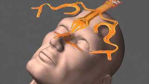 Stryker Thyroid Autoregistration Mask Instructional Video