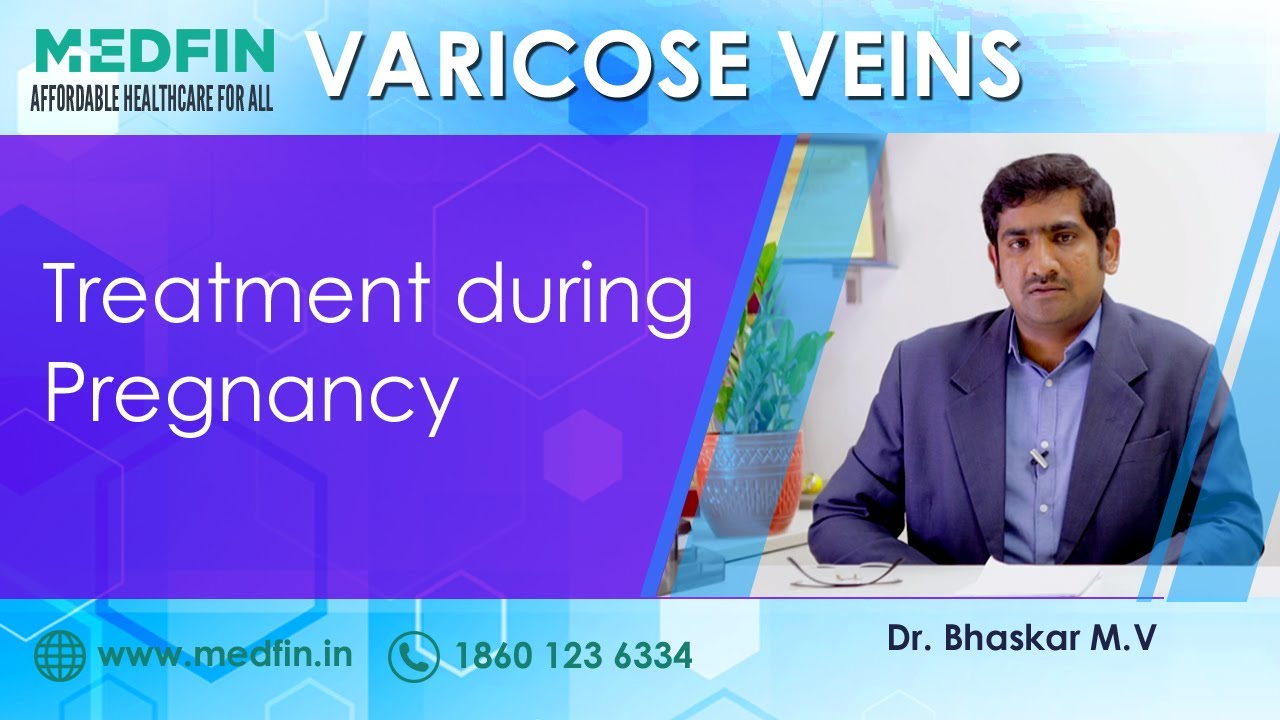 Varicose Veins during pregnancy explained YouTube
