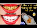 मसूड़ों में सूजन,दर्द,खून,दांत में दर्द ,मुंह से बदबू इन सबके लिए बेस्ट घरेलू उपाय | Teeth Whitening