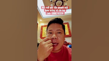 Nốt ruồi của người dễ kiếm tiền #tuvituongsohanoi #xemtuong