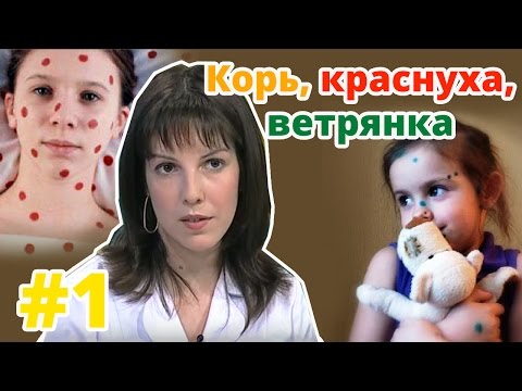 Видео: Разница между корью и ветряной оспой