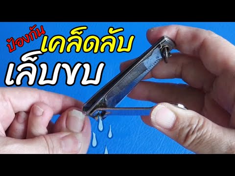 #วิธีแก้เล็บขบ #วิธีตัดเล็บที่ถูกต้อง