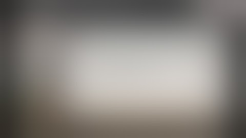 Laproscopic Partial Nephrectomy || Urology ||