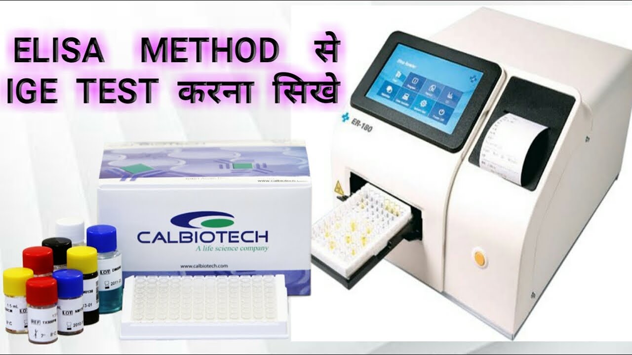 HOW TO TEST SERUM IgE TEST BY ELISA // RENUVERMAN YouTube