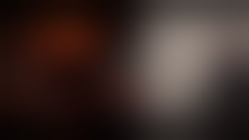 Robotic Hepatectomy Of Segment III