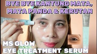 REVIEW MS GLOW EYE TREATMENT SERUM -EYE SERUM CREAM UNTUK MATA MATA |EYE TREATMENT SERUM MSGLOW