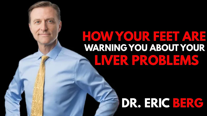 How Your Feet Are Warning You About Your Liver Problems - Dr. Berg Explains