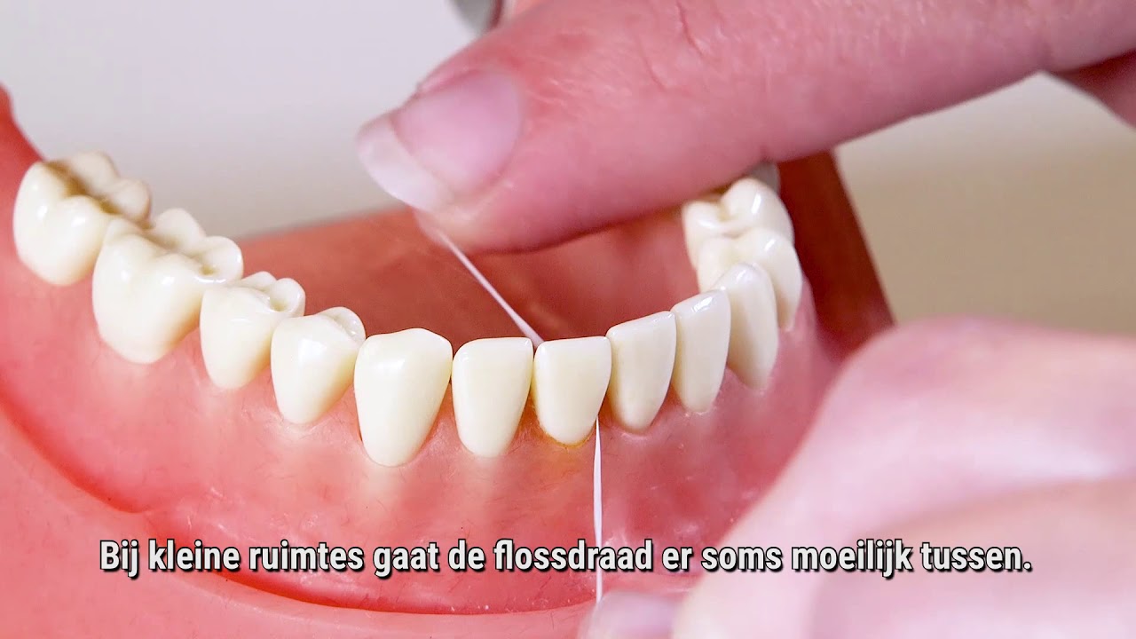 Paro Praktijk Utrecht Instructie Flossen