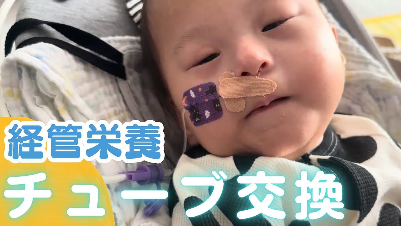 【哺乳の力が弱い赤ちゃん】ミルクの注入/生まれてからこれまで