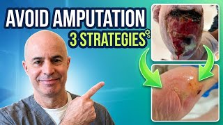 Avoid Amputation! Advanced Wound Care That SAVES Legs