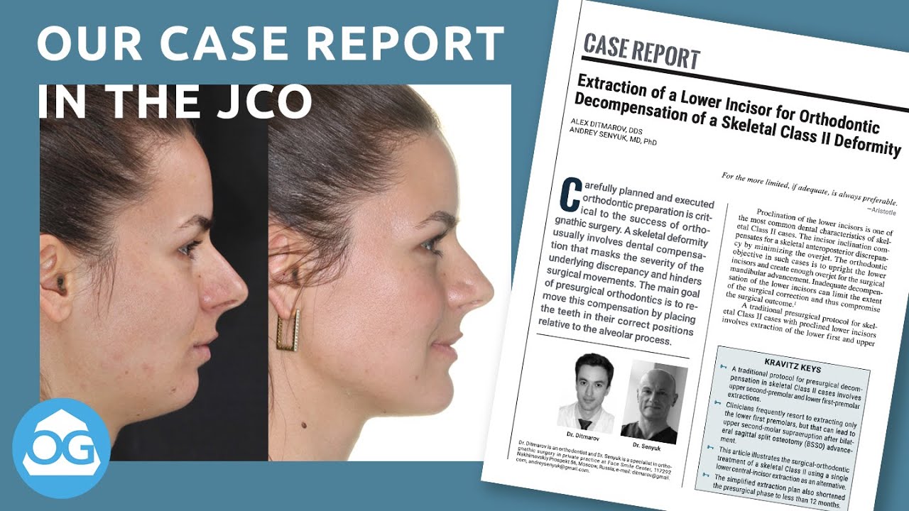 Our case report in the Journal of Clinical Orthodontics