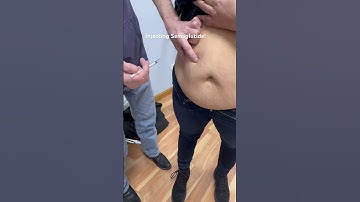 Injecting  Semaglutide #weightloss #semaglutideweightloss #injection #beauty #fitness  #obesity