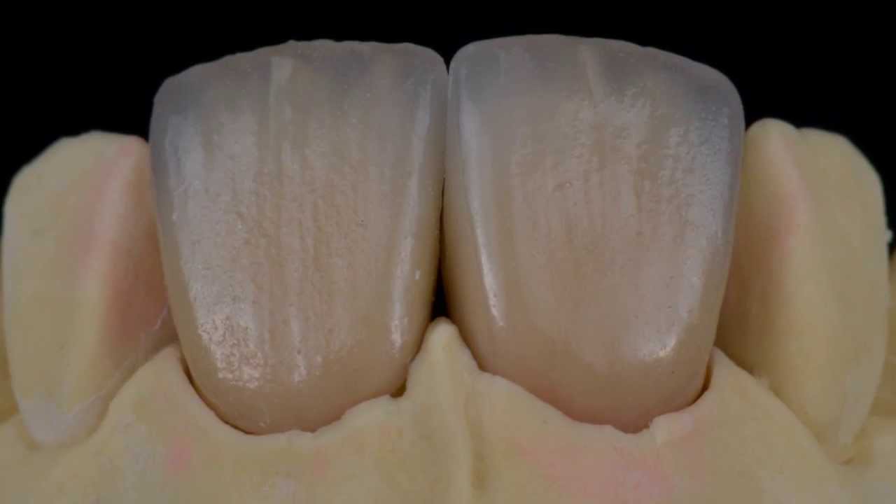 Stratification Signature by C-Ferrari par Denis Rizzo