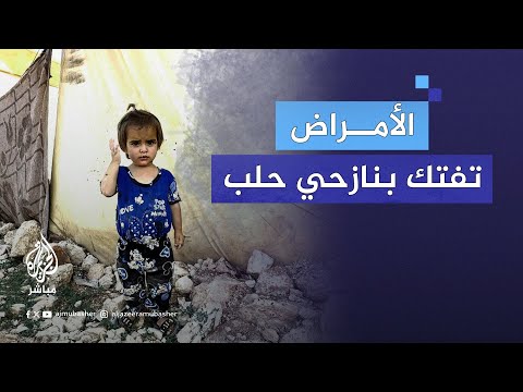 داء الليشمانيا أمراض جلدية فتاكة تصيب سكان مخيم وضاح شمالي حلب