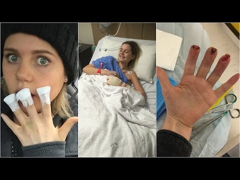 *WARNING GRAPHIC* | MY FINGER AMPUTATION!