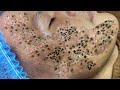 ASMR Facial Treatment & Scalp Massage | Best video for facial cleaning of 2026