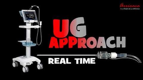 ULTRASOUND GUIDED COSTOCLAVICULAR APPROACH TO BRACHIAL PLEXUS IN PEDIATRICS