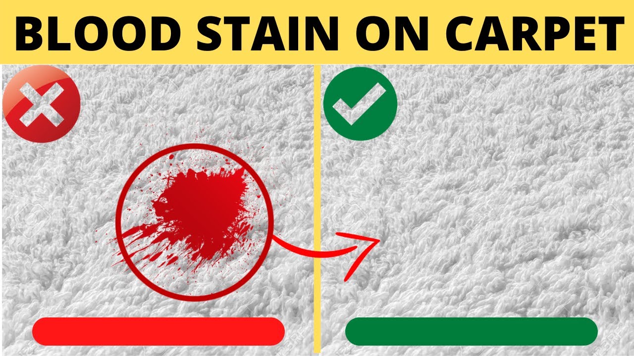 Remove Blood Stains - How to Get Out Blood Out of Carpet