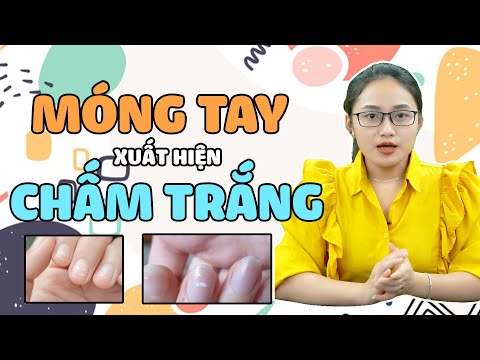 Móng Tay Có Chấm Trắng Cảnh Báo Điều Gì? | #Shorts