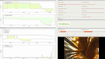 Parameter Estimation And Anomaly Detection