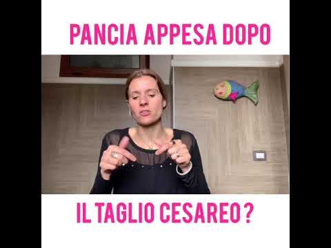 Video: Come Stringere La Pancia Dopo Un Taglio Cesareo?