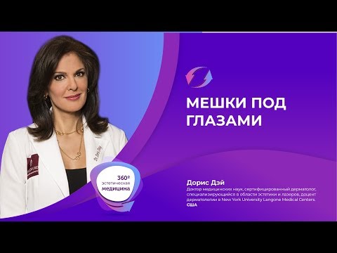 ✔ Как Бороться с Отеками под Глазами | Мешки под глазами 👁 Причины Возникновения и Виды