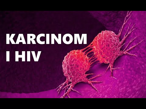 Video: HIV In Rak: Tveganja, Vrste In Možnosti Zdravljenja