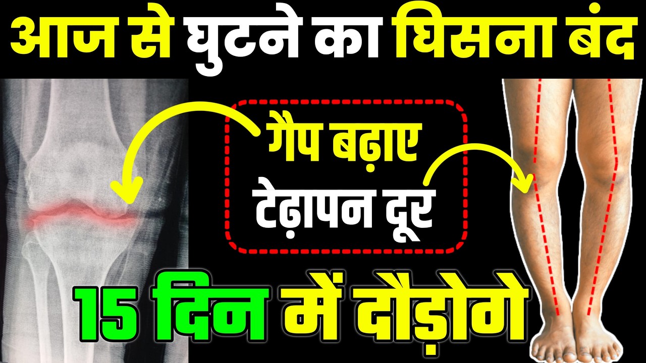 घिसे हुए घुटने का गैप बढ़ाएं पैर मजबूत करें|Knee Pain Exercises|Knee Joint Pain Relief Exercises