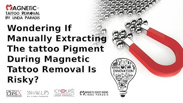 Is it Risky to Extract tattoo Pigment with Magnetic Tattoo removal Technique?
