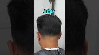 $300 To Fix His Bald Spot 😱💰 Profile