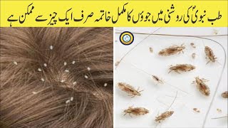 Anti lice remedy urdu hindi |جوؤں اور لیکھوں کامکمل خاتمہ | Best conditioner for hairs